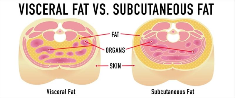 visceral fat vs subcutaneous fat