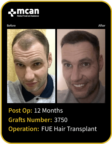 before after