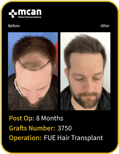 before after
