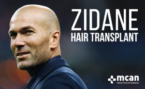 Spotted Undercover: Zidane Hair Transplant in Istanbul!