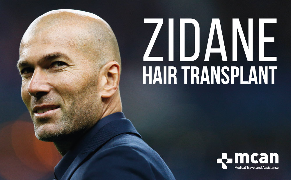 ZIDANE HAIR TRANSPLANT