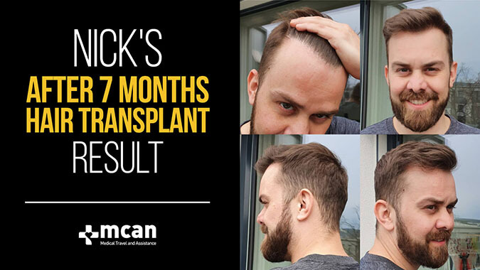 fue hair transplant turkey animation