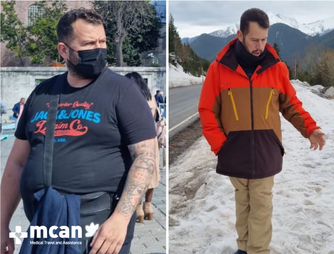 Antes y después de la cirugía bariátrica 5