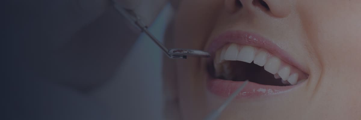 Coronas dentales (fundas dentales) en Turquía