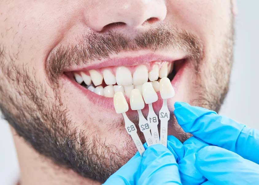 Why Travel to Turkey for Dental Veneers?