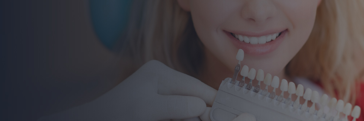 Carillas dentales en Turquía | MCAN Health