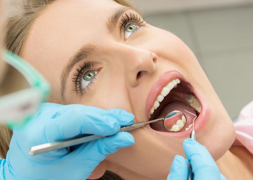 Todos los detalles sobre el blanqueamiento dental en Turquía
