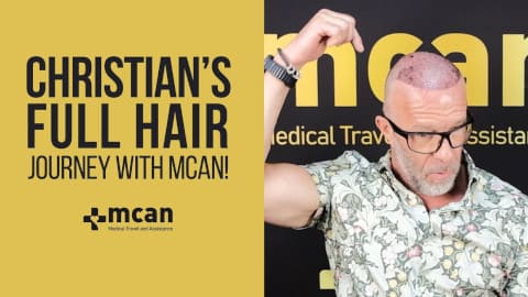 Hair Implants Turkey - Pure Rock & Roll with MCAN