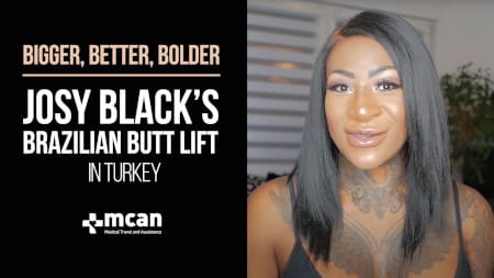 Plastic Surgery in Turkey: Josy Black's Liposuction and Brazilian Butt Lift (BBL) with MCAN Health