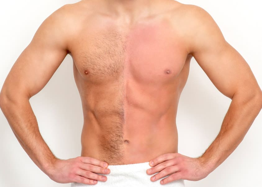 Simple Guide to Body Hair Transplantation