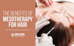 Mesotherapy for Hair