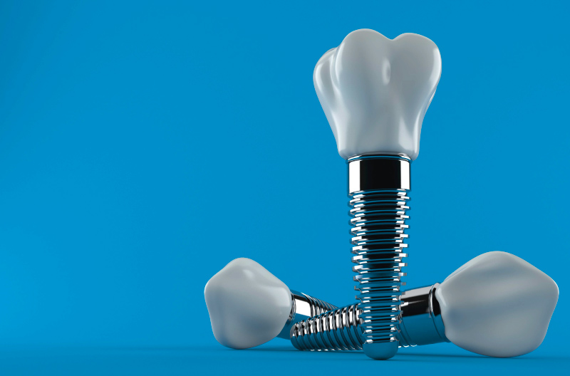 Can I Get Dental Implants on the NHS? 1 implant gorsel1 Dental implants on NHS