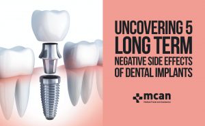 Uncovering 5 Long Term Negative Side Effects of Dental Implants