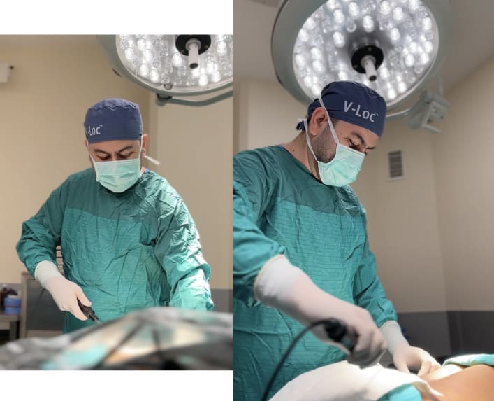 Best Liposuction Doctor in Istanbul Turkey