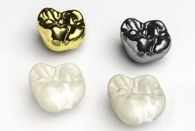 step by step dental crown procedure