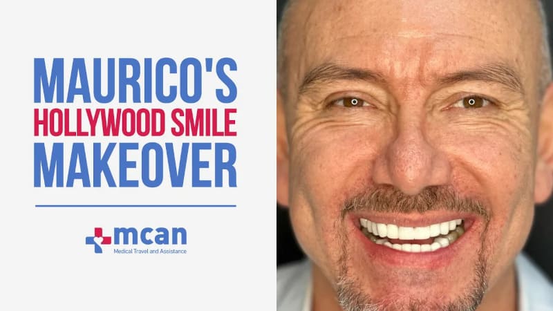 Maurico's Hollywood Smile Makeover in Turkey with MCAN HEALTH