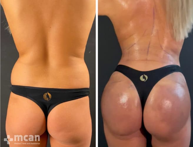 satisfying results after plastic surgery