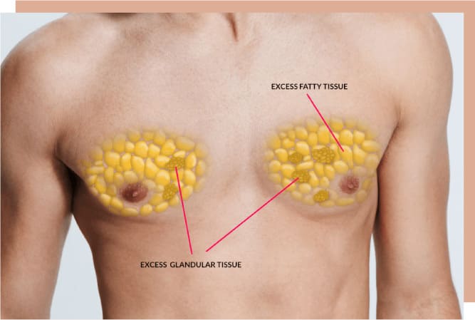 step by step gyno procedure