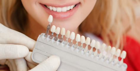 Porcelain Veneers