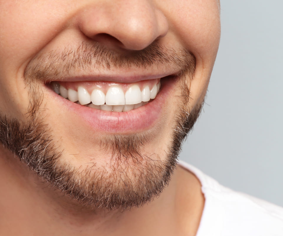 teeth whitening procedure