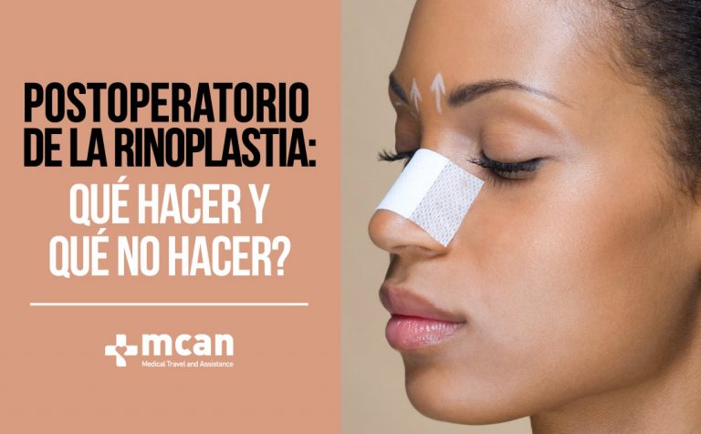 Postoperatorio de la Rinoplastia: Qué Hacer y Qué No Hacer? 16 Postoperatorio de la rinoplastia MAILING Postoperatorio de la rinoplastia MAILING
