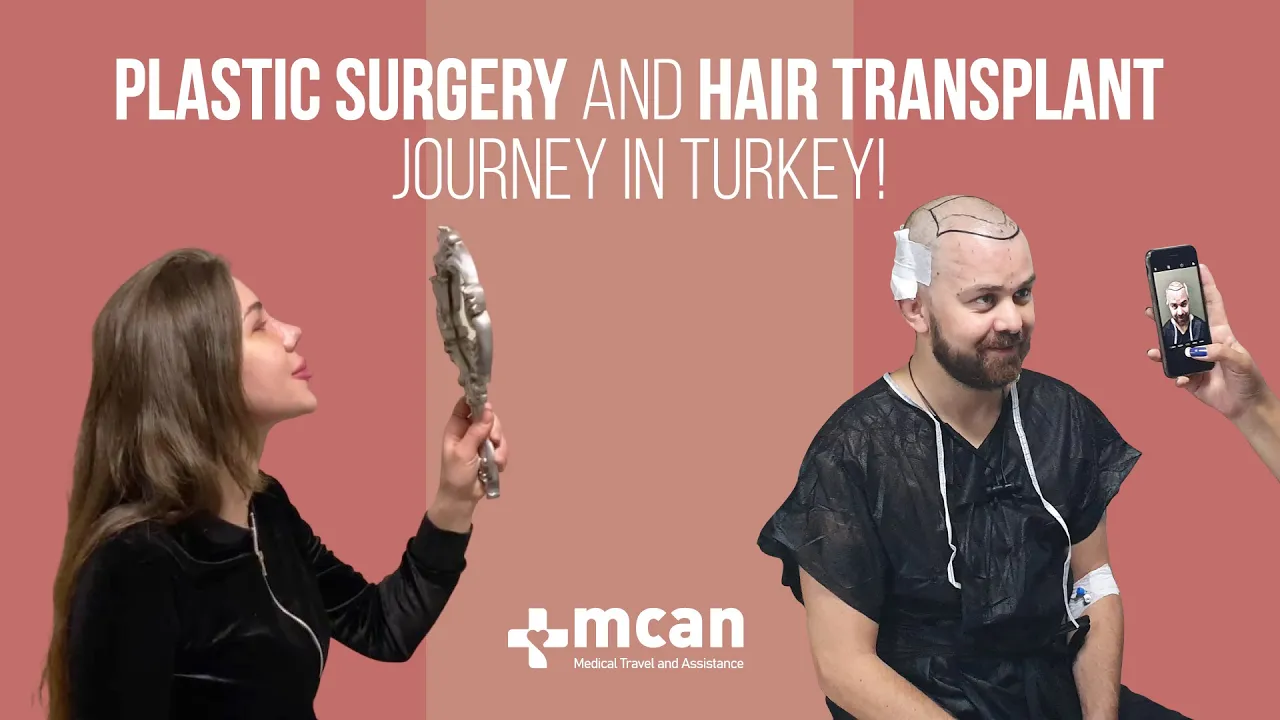 Hair Transplant and Plastic Surgery in Turkey - Journey Video with MCAN Health!