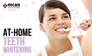 At-Home Teeth Whitening: An Easy Way to Get Your Teeth Brighter