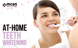 At-Home Teeth Whitening: An Easy Way to Get Your Teeth Brighter