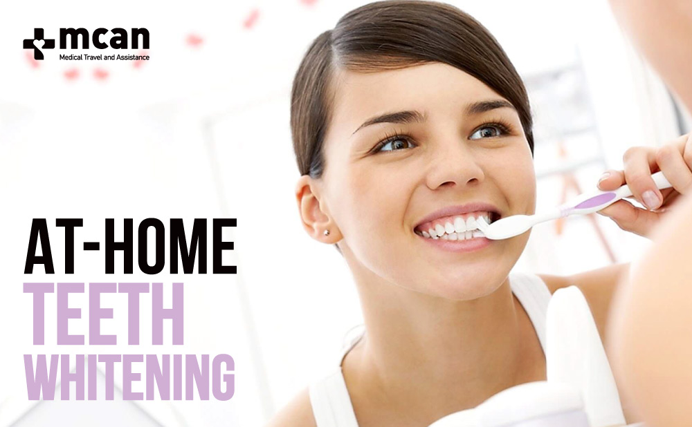 at-home teeth whitening