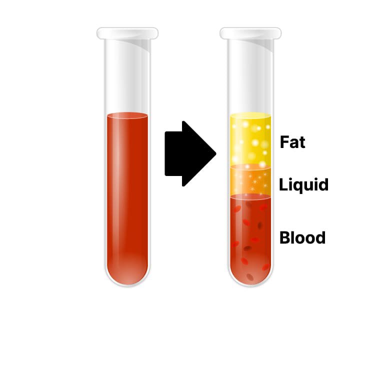 BBL Fat Purification