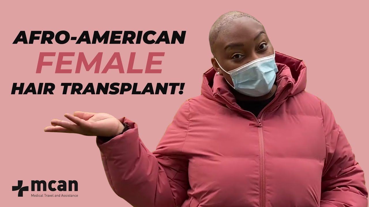 Afro-American Female Hair Transplant with MCAN Health in Turkey!