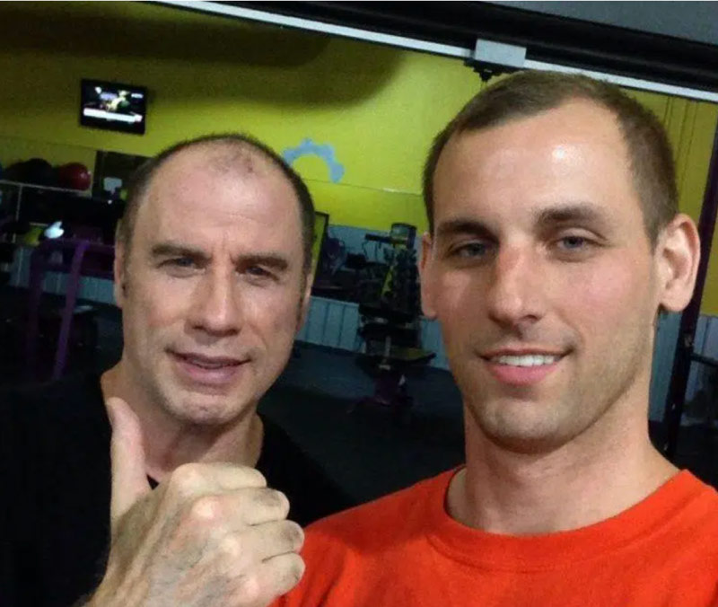 Has John Travolta had a hair transplant