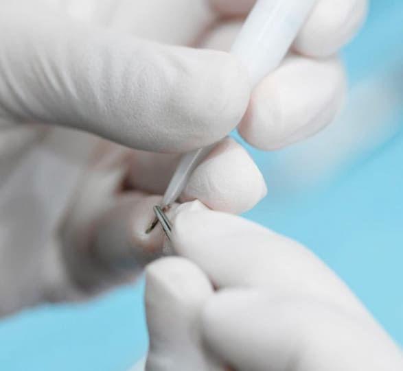 Подкожная пересадка волос в Турции 16 what you shouldnt expect from dhi hairtransplant Was Sie von DHI nicht erwarten können