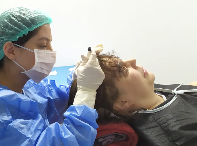 Beste Haartransplantation für Frauen in der Türkei