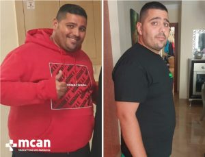 body goals achieved with weight loss surgery