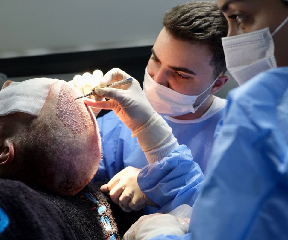 MCAN Health FUE Haartransplantation