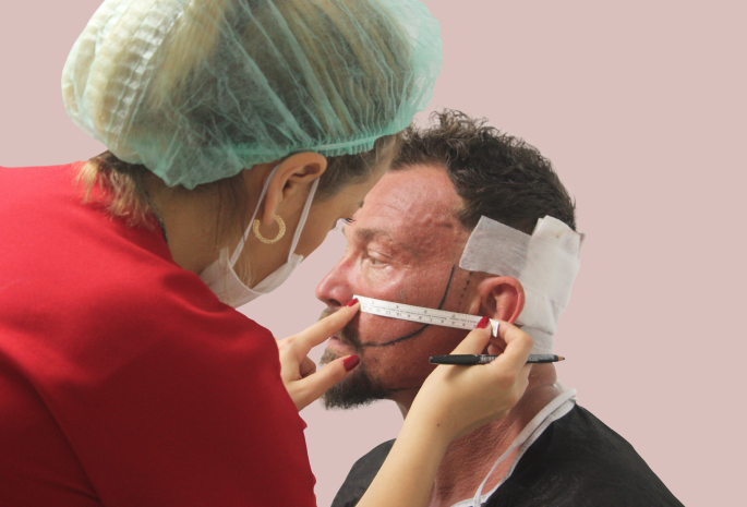 Beste Artz für Barttransplantation in der Türkei