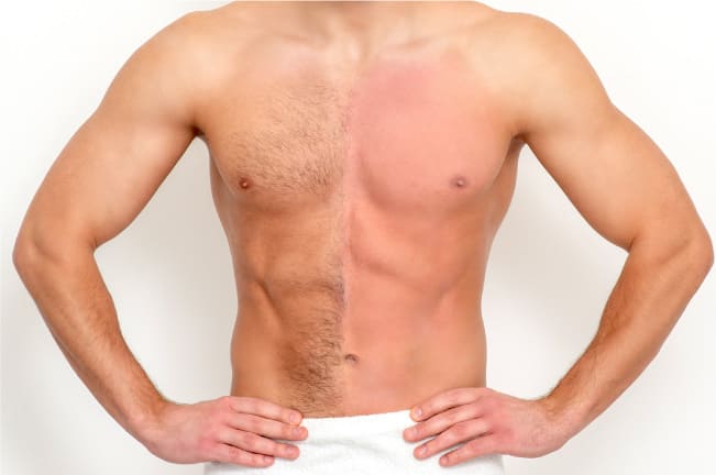 Are you eligible for a body hair transplant?