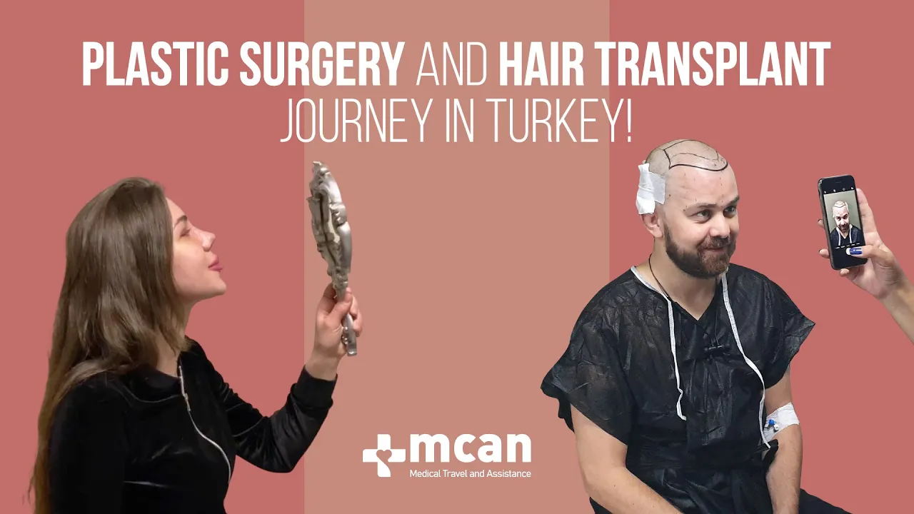 Barttransplantation in der Türkei