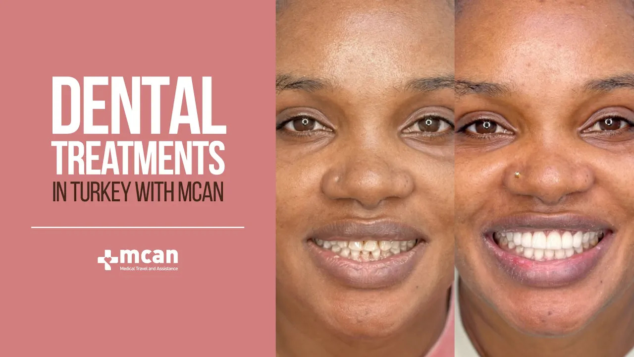 Teeth Whitening at MCAN Health