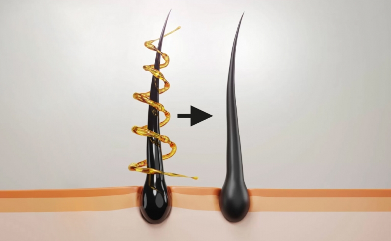 Is Hair Cloning the Future of Flawless Hair Restoration? 11 Hair Clone2 is hair cloning possible