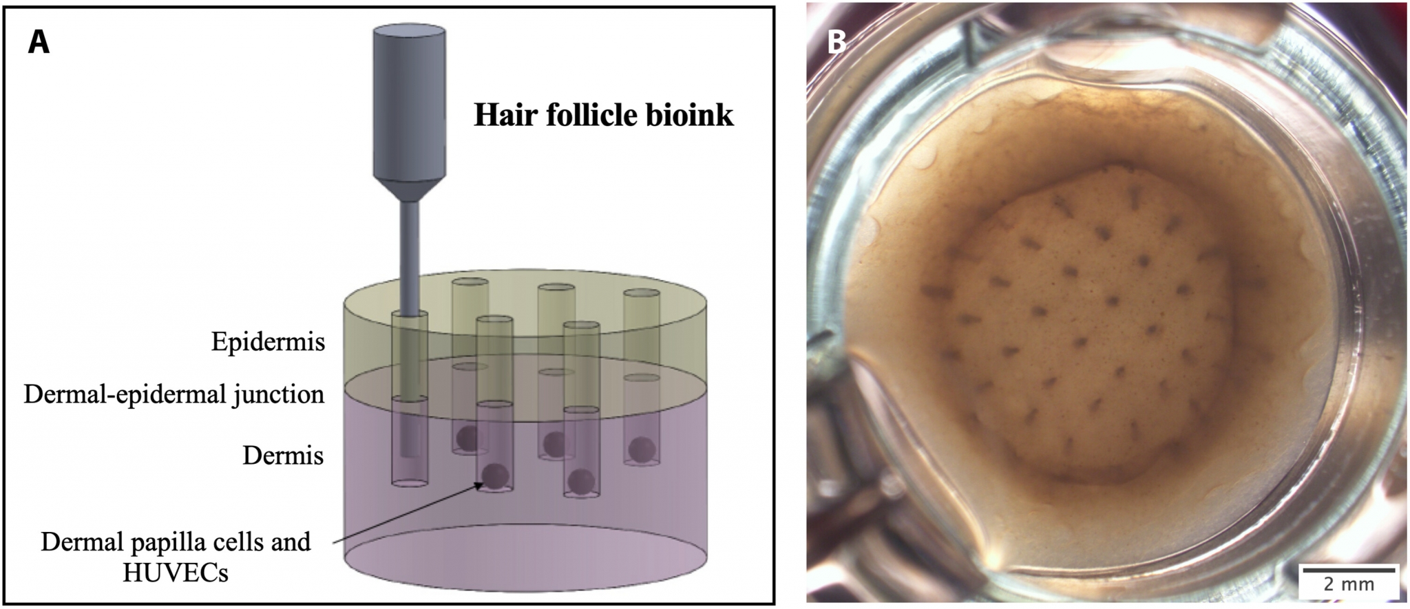 Is Hair Cloning the Future of Flawless Hair Restoration?