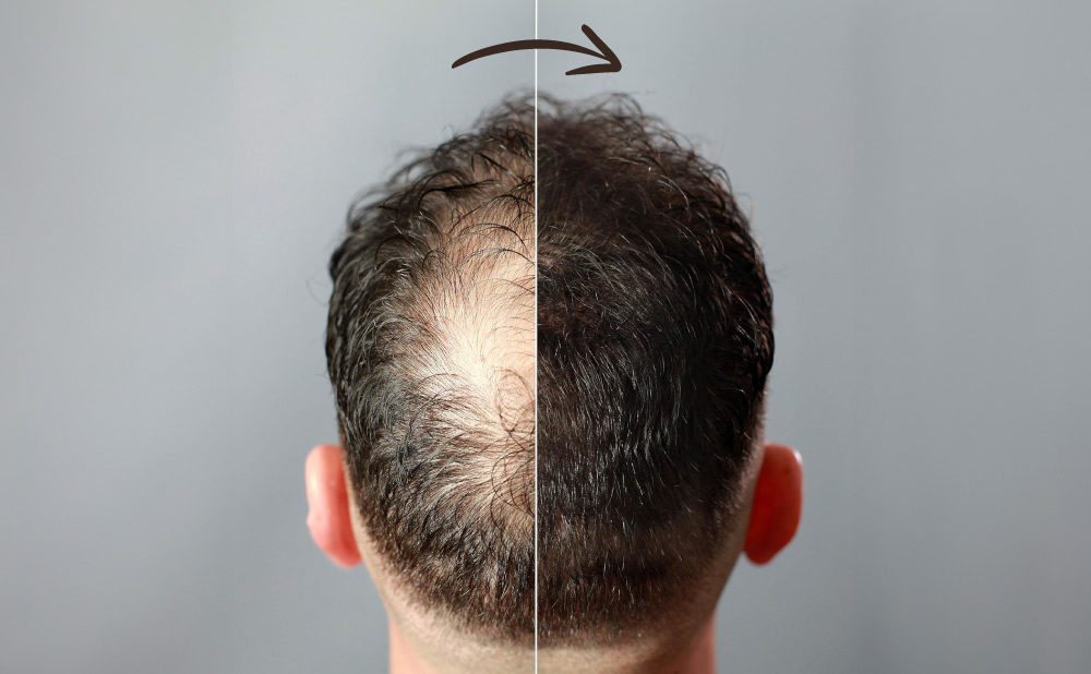 photo of how to thicken hair