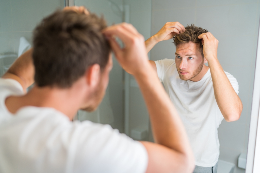 men experiencing a hair loss 