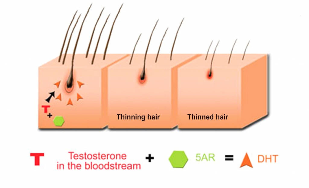 hair loss and hair receding explanation 