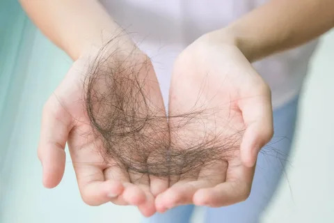 hair loss due to pulling hair out 