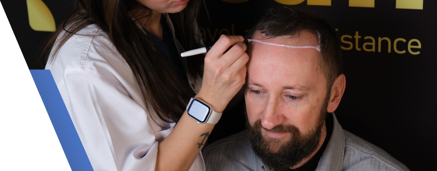 hair transplant pre op