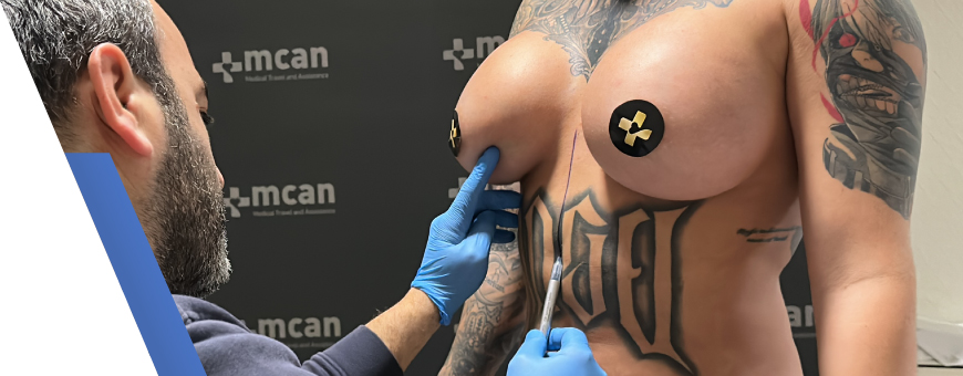 plastic surgery pre op