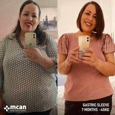 Actual MCAN Health patient before and after Treatment