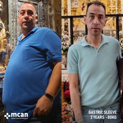 Actual MCAN Health patient before and after Treatment